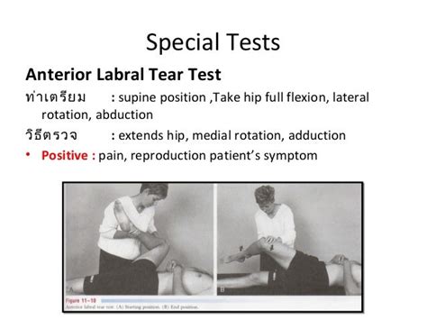 acetabular labral tear orthopedic test|acetabular labrum tear pain characteristics.